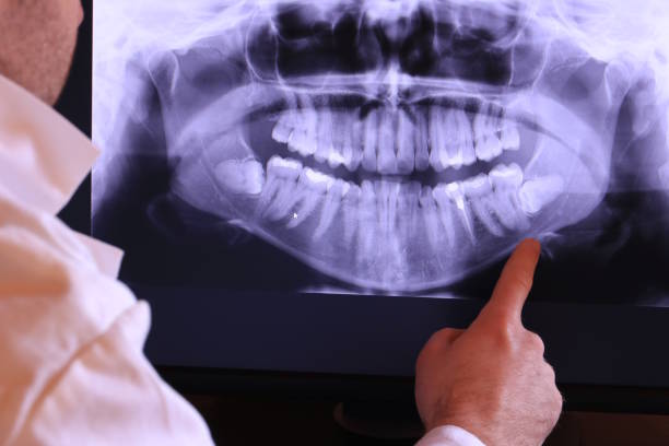 Best Emergency Tooth Extraction in Hattiesburg, MS